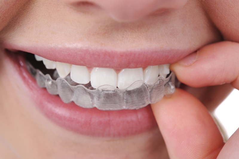 Dental Gallery 7