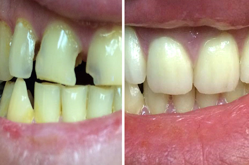 Dental Gallery 13