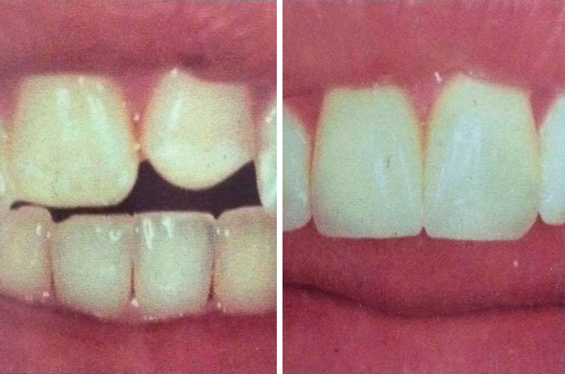 Dental Gallery 14